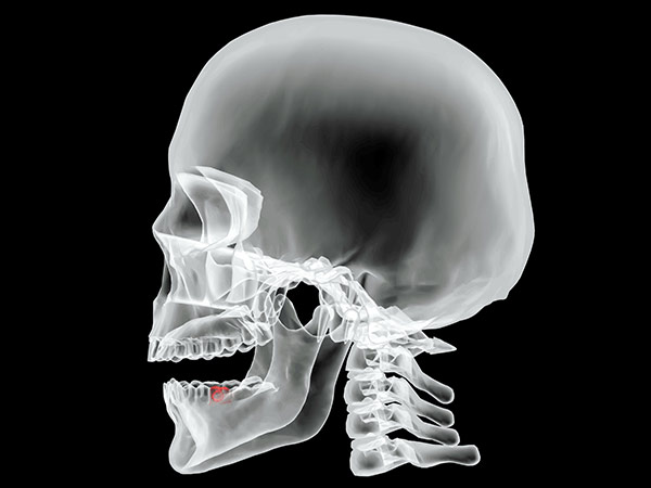 Disorders of the Jaw