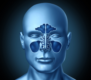 balloon sinuplasty