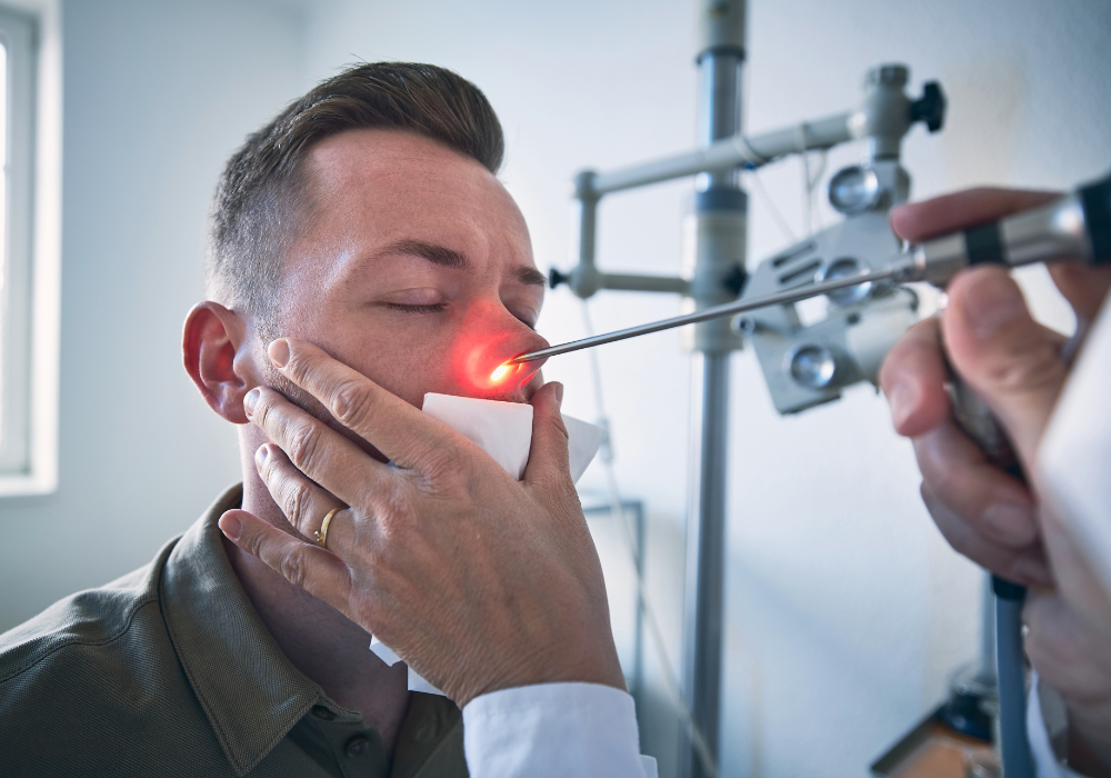 balloon sinuplasty