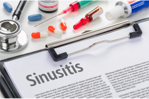 sinusitis